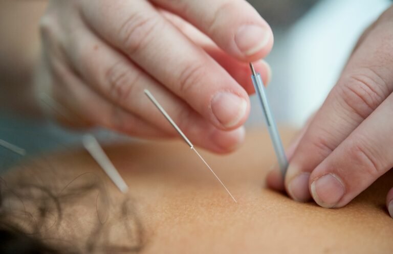 How to Use Acupressure for Pain Relief